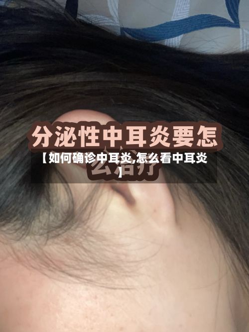 【如何确诊中耳炎,怎么看中耳炎】-第2张图片