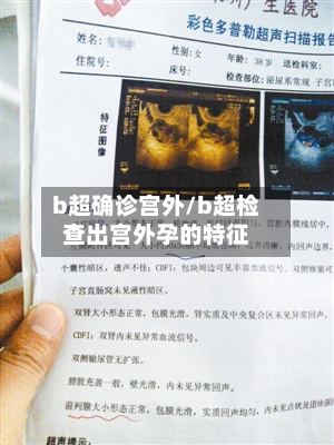 b超确诊宫外/b超检查出宫外孕的特征-第2张图片