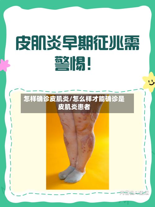 怎样确诊皮肌炎/怎么样才能确诊是皮肌炎患者-第2张图片