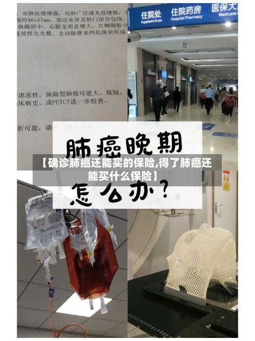 【确诊肺癌还能买的保险,得了肺癌还能买什么保险】-第2张图片
