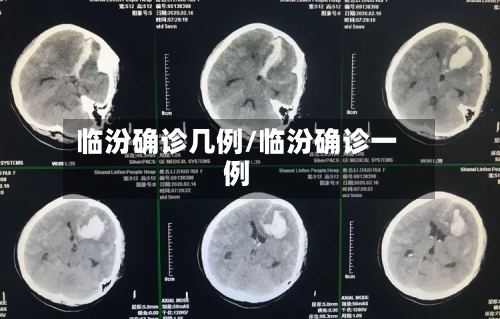 临汾确诊几例/临汾确诊一例