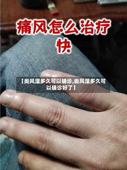【类风湿多久可以确诊,类风湿多久可以确诊好了】-第2张图片