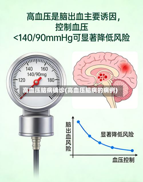 高血压脑病确诊(高血压脑病的病例)