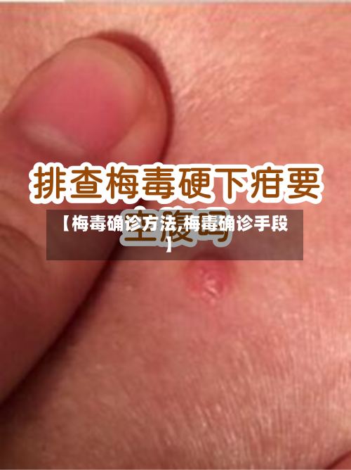 【梅毒确诊方法,梅毒确诊手段】-第2张图片