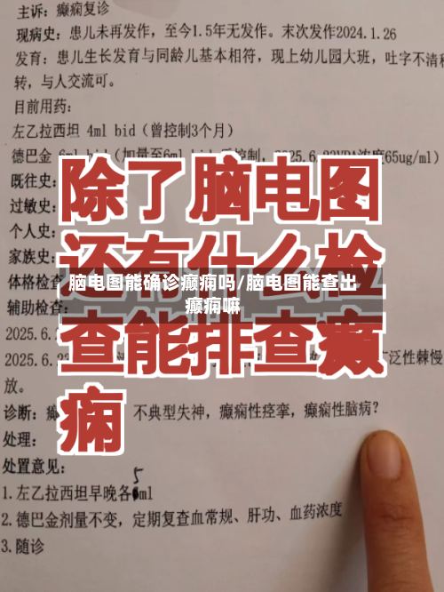 脑电图能确诊癫痫吗/脑电图能查出癫痫嘛