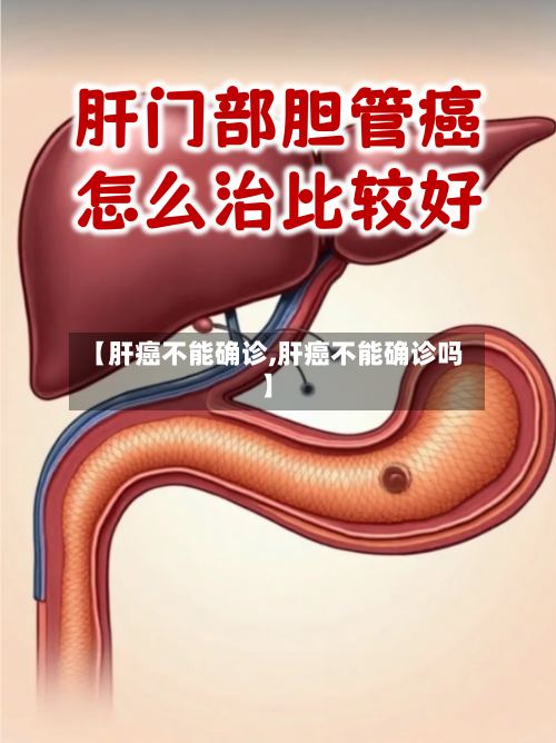 【肝癌不能确诊,肝癌不能确诊吗】