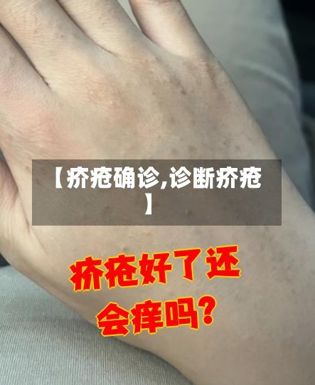 【疥疮确诊,诊断疥疮】-第2张图片