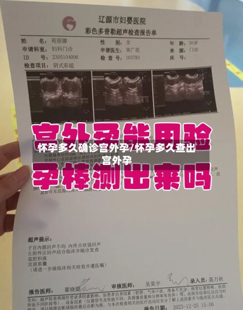 怀孕多久确诊宫外孕/怀孕多久查出宫外孕