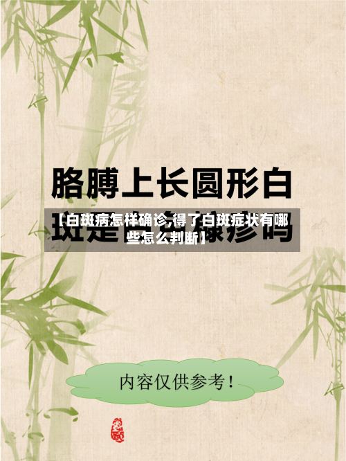 【白斑病怎样确诊,得了白斑症状有哪些怎么判断】