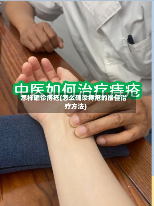 怎样确诊痔疮(怎么确诊痔疮的最佳治疗方法)-第3张图片