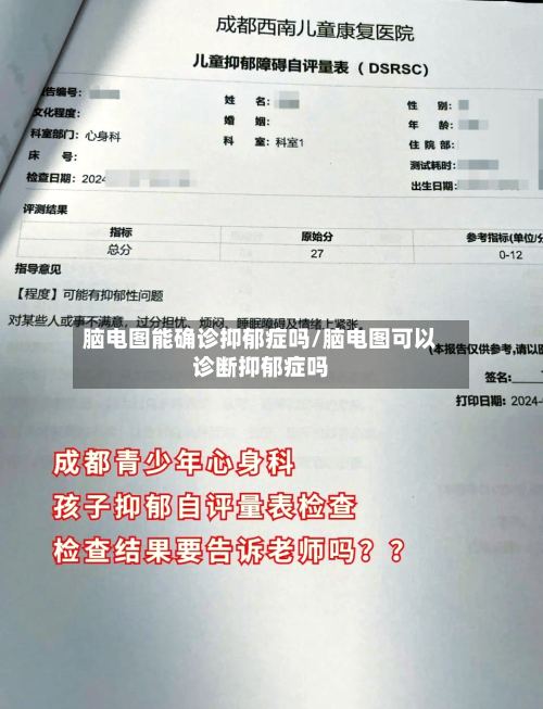 脑电图能确诊抑郁症吗/脑电图可以诊断抑郁症吗