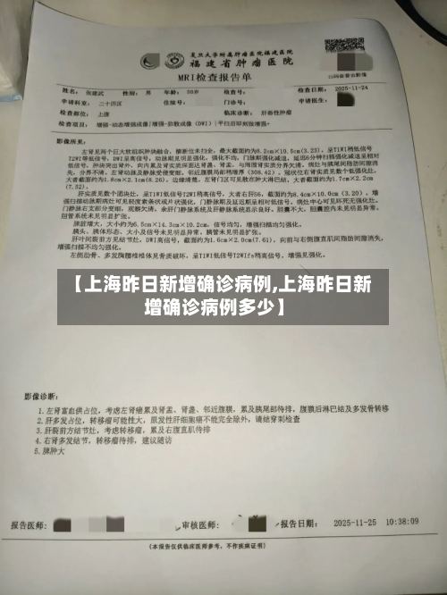 【上海昨日新增确诊病例,上海昨日新增确诊病例多少】-第2张图片