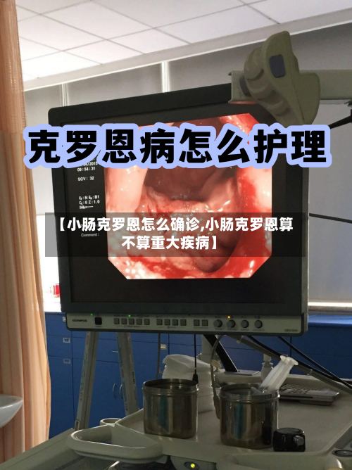 【小肠克罗恩怎么确诊,小肠克罗恩算不算重大疾病】