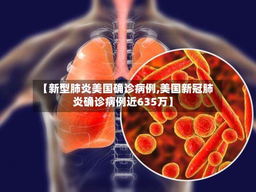 【新型肺炎美国确诊病例,美国新冠肺炎确诊病例近635万】