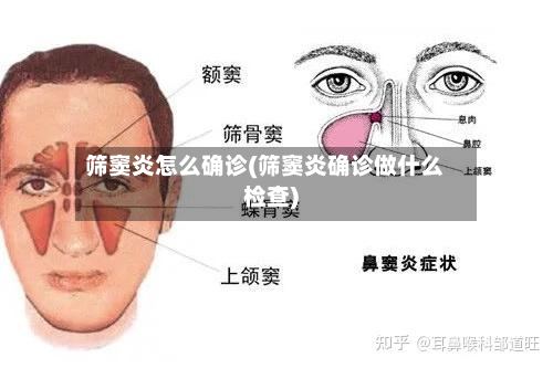 筛窦炎怎么确诊(筛窦炎确诊做什么检查)-第2张图片