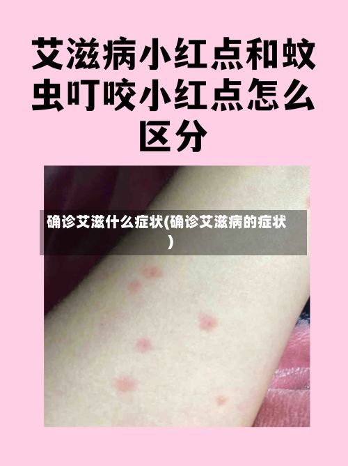确诊艾滋什么症状(确诊艾滋病的症状)-第3张图片