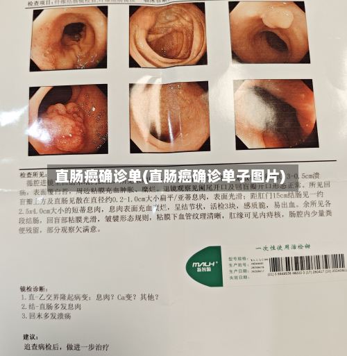 直肠癌确诊单(直肠癌确诊单子图片)-第3张图片